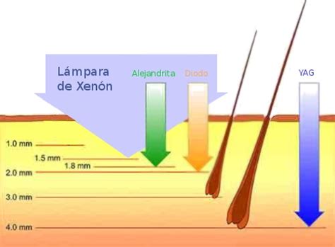 Depilación con láser conoce los tipos de láser para tu piel Hair Topel G