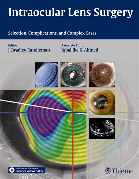 Intraocular Lens Surgery | 9781626231146 | Thieme Webshop