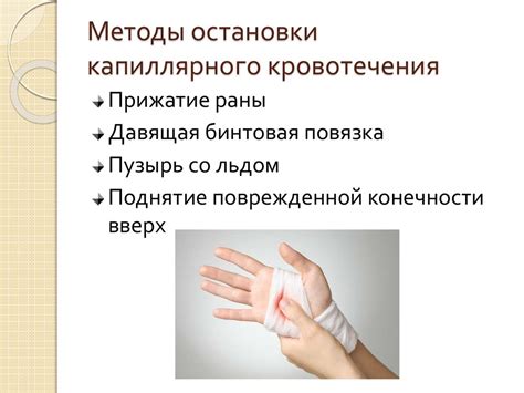 Виды кровотечений. Методы остановки кровотечений - презентация онлайн