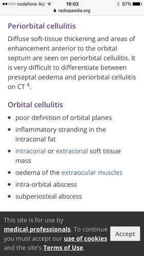 Periorbital And Orbital Cellulitis Flashcards Quizlet