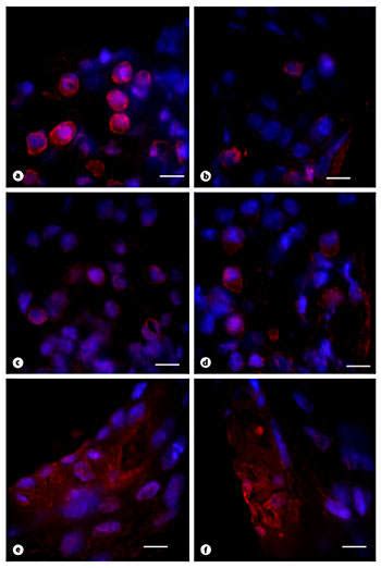 Caspase 3 Activation Was Decreased In The Cochlea Of VDR KO Compared