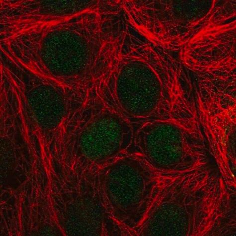 Anti Tff Antibody Produced In Rabbit