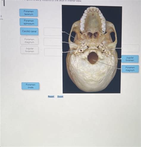 [Solved]: 3 nts Foramen lacerum Foramen spinosum Carotid ca