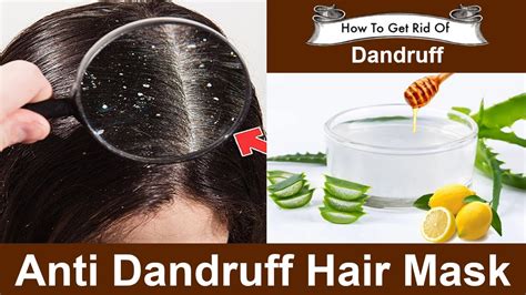 Anti Dandruff Hair Mask Best Hair Mask For Dandruff Youtube