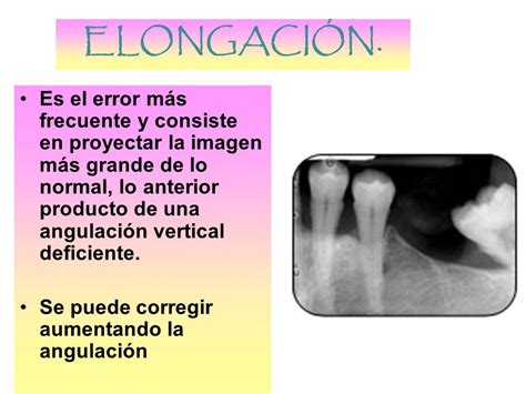 Radiología 3 PARCIAL 5 ERRORES TÉCNICOS MÁS COMUNES EN LA TOMA DE Rx