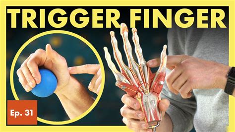 Stenosing Tenosynovitis Trigger Finger Causes - madathos