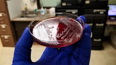 Blood Agar Culture Plate With Salmonella Colonies Stock Image Image