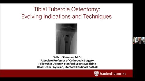 Tibial Tubercle Osteotomy Evolving Indications And Techniques