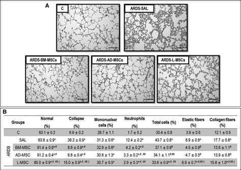 Lung histology. A, Representative photomicrographs of lung parenchyma... | Download Scientific ...