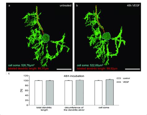 Morphometric Analysis Of VEGF Effects On Mature PC Dendrites And Cell