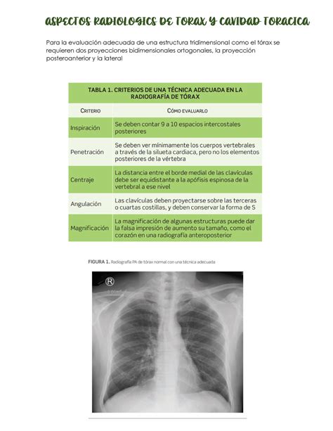 Aspectos Radiologicos Para la evaluación adecuada de una estructura