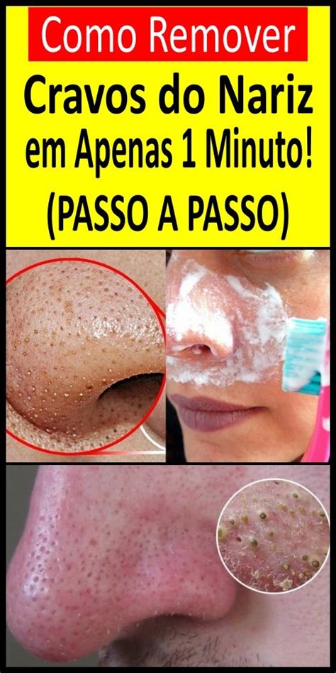 Como Remover Cravos Do Nariz Em Apenas Minuto Spa Day Skin Beauty