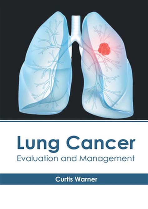 Lung Cancer Evaluation And Management 9781632418838 Boeken Bol