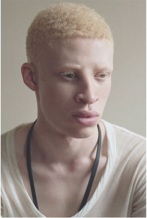 Albino male model – Wkcn