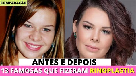 Antes E Depois De 13 FAMOSAS BRASILEIRAS Que Fizeram RINOPLASTIA