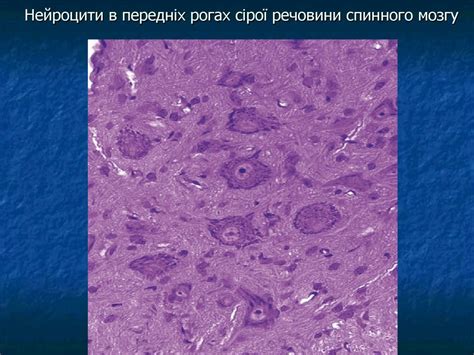 Нервова система. Органи чуття - online presentation