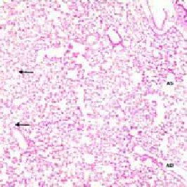 A Photomicrograph Of A Section In The Lung Of A Control Rat Showing