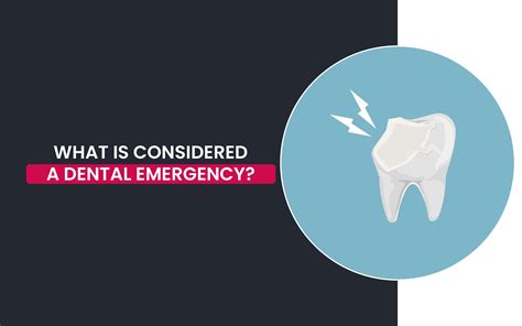 What Is Considered A Dental Emergency