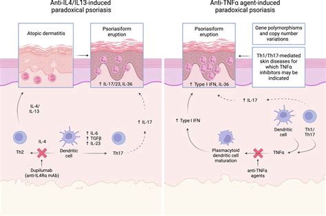 Paradoxical Psoriasis An Updated Review Of Clinical Features Pathogenesis And Treatment