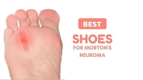 Best Shoes For Morton S Neuroma 2024 For Extreme Relief Lux Render