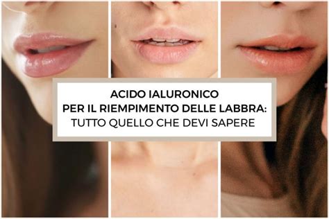 Acido Ialuronico Per Il Riempimento Delle Labbra Tutto Quello Che Devi