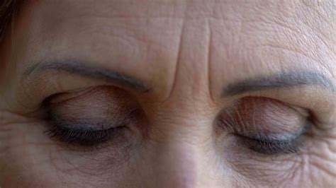 Guide To 7 Facial Wrinkles Smoothed By Botox