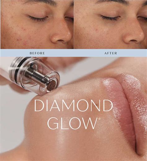 Diamond Glow Facial Ageless Image Medical Spa