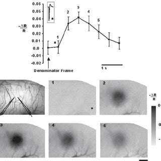 Optical Imaging Of Intrinsic Signals Reveals The Functional