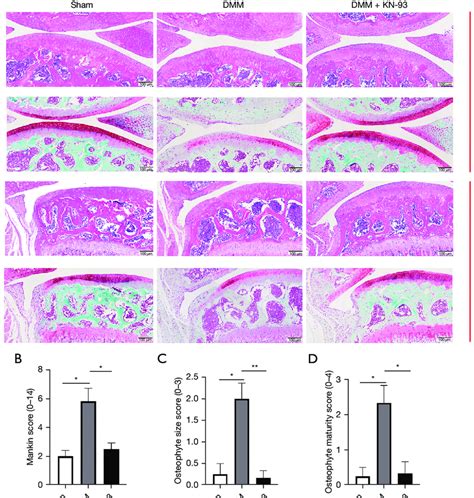 Inhibition Of Camk Expression Protects The Articular Cartilage In Dmm