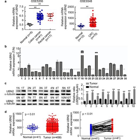 Ubn Is Upregulated In Crc Tissues A The Expression Of Ubn Analyzed