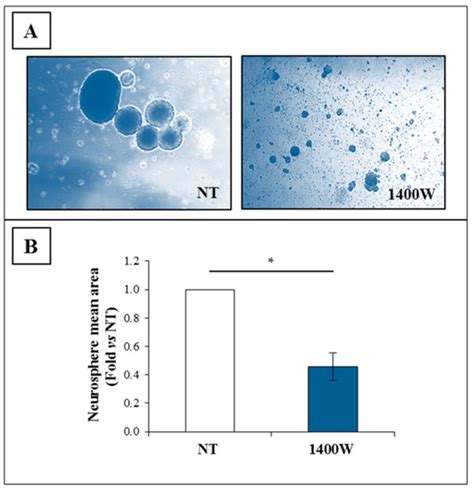 Ijms Special Issue Intracranial Malignancies Molecular Insights