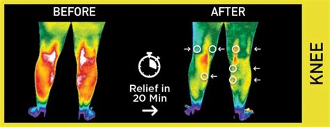 Relief Disc Miracle Balance