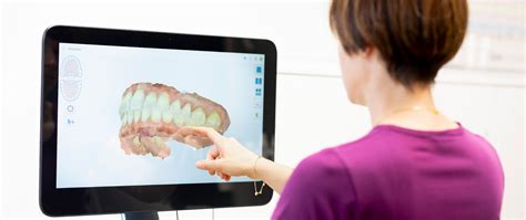 Digitaler Abdruck Intraoral Scanner Adelsdorf Dr Lücking