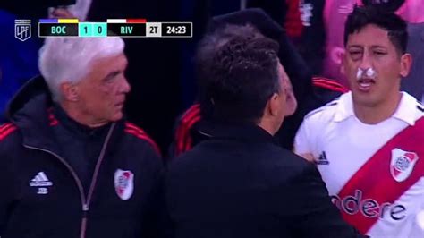 Susto En River Rodrigo Aliendro Fue Internado Tras Sufrir Una Fractura