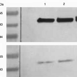 This figure provided exhibits an exemplar of a western blot membrane... | Download Scientific ...