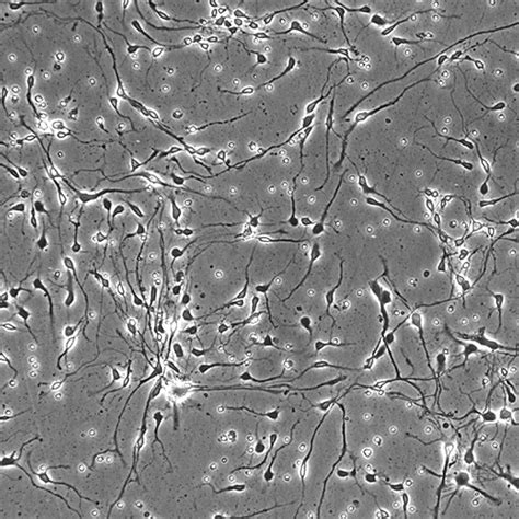 Human Neurons Innoprot Brain Cell System