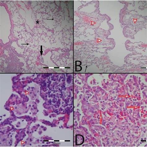 Histological Changes In Lung Tissues Of LPS Induced Phase 1 ARDS Rats