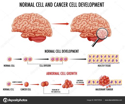 Diagrama Que Muestra Ilustración Células Normales Células Cancerosas