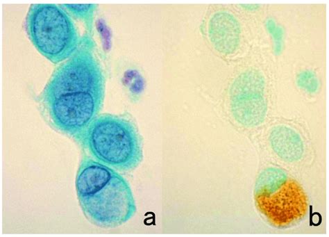 Re Staining Of A Cytology Specimen With Chlamydia Trachomatis