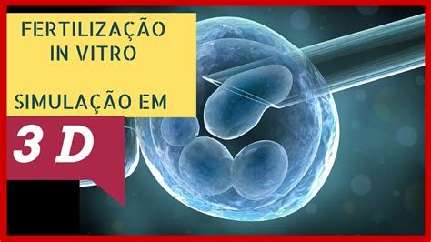 Como Feito A Fiv Fertiliza O In Vitro Insemina O Artificial Em