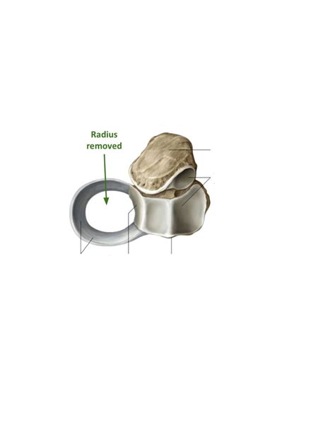 Annular Ligament of the Radius Diagram | Quizlet