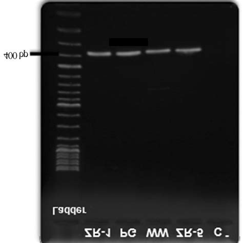 Electrophoresis Of Pcr Amplification Of 16s Rrna On Agarose Gel 08