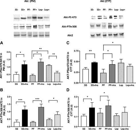 Central Leptin Administration Alters The In Vivo Insulin Induced Akt