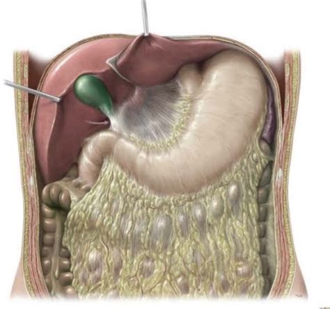 4. Greater and Lesser Omentum Diagram | Quizlet