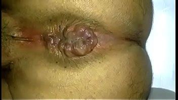 Tin Inside Ass XVIDEOS