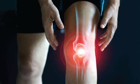 New Treatments For Knee Arthritis Now Available South Florida Health