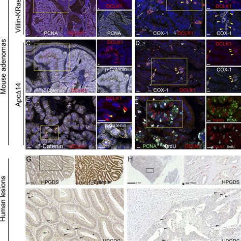 Tuft Cells Appear After Birth Immunofluorescent Staining For Dclk1 And