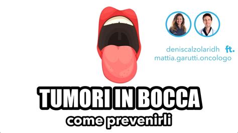 Tumori In Bocca Come Prevenirli Dr Mattia Garutti YouTube