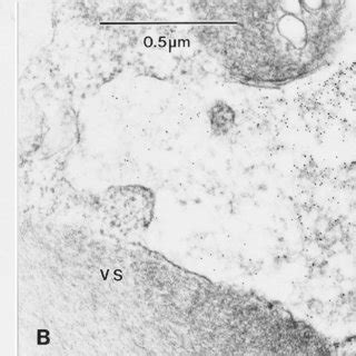 Immunoelectron Microscopy Examination Of Acnpvp Infected Cells Cells