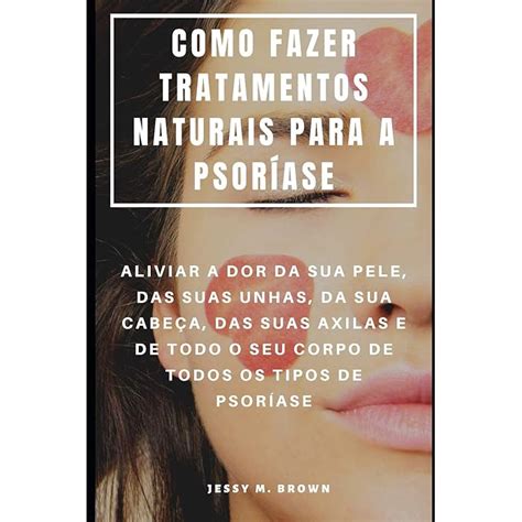 Buy Como Fazer Tratamentos Naturais Para a Psoríase Aliviar a Dor Da